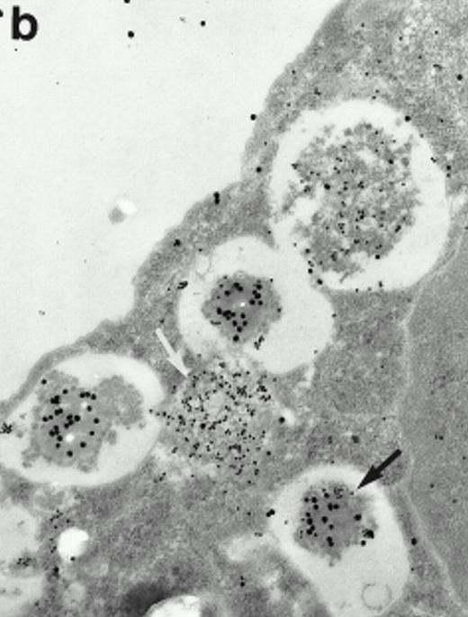 Fig. 7. Localization of proMBP and MBP in day-24 IL-5–induced UCC by immunoelectron microscopy using double labeling. ProMBP was localized with 15-nm colloidal gold particles and MBP with 30-nm gold particles. (a) Although proMBP labeling (small gold) is seen throughout the Golgi, it is concentrated predominantly in the large uncondensed granules (white arrow); only minimal MBP labeling (large gold) is evident in the large granules. In contrast, the small condensed granules show marked MBP labeling in the interior and minimal proMBP labeling at the periphery (black arrow). (b) At higher magnification, dense labeling for proMBP (small gold) and minimal labeling for MBP (large gold) is evident in a large uncondensed granule (white arrow). The black arrow identifies a small condensed granule that contains predominantly MBP, along with minimal proMBP at the periphery. (a) Original magnification ×11,000; (b) ×20,000.