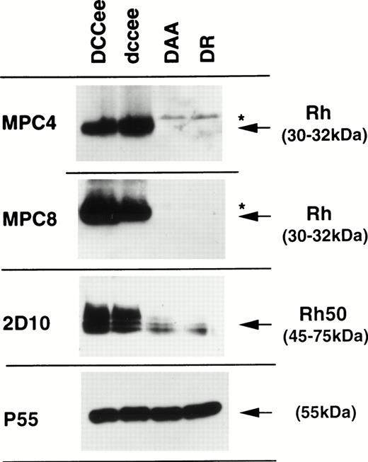 Fig. 1. Immunostaining of RBC membrane proteins from erythrocytes of DAA and DR patients. RhD-positive (DCCee) and RhD-negative (dccee) membrane proteins were used as controls. The Rh50 glycoprotein carries an N-linked polylactosylaminyl carbohydrate chain2 and is shown as a band of 45- to 75-kD. Antibodies (see the Materials and Methods) are identified on the left-hand side. Stars indicate nonspecific bands occasionally seen from sample to sample and masked in controls due to high intensity of the Rh-specific band.