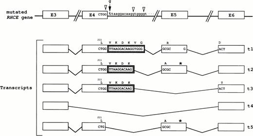 Fig. 3. RHCE gene mutation and transcripts in patient DAA. The invariant g residue at the donor splice-site in intron 4 is mutated to t. The three cryptic splice-sites are indicated by open arrowheads. The schematic representation of the exons 3 to 6 (E) and introns in the mutated gene is shown (not to scale), as well as those of the amplified regions (see text) of 5 different transcripts (t1 through t5). The first 16 and 11 nucleotides of intron 4 (hatched boxes) were included in t1 and t2/t3 transcripts, respectively. The 6 and 4 amino acid residues inserted in the corresponding predicted proteins are indicated. The smaller transcript, t4, resulted from the skipping of both exons 4 and 5 nucleotide regions. Transcript t5 differs from the normal RhCE cDNA only by the deletion of the last G nucleotide of exon 4. The approximate positions of stop codons in t2 and t5 transcript are indicated by stars.