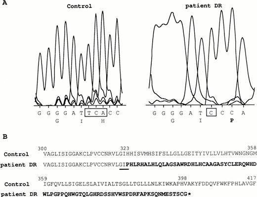 Fig. 4. RHCE cDNA mutation in patient DR. (A) The TCA nucleotide sequence, present in the RhD-negative control, is mutated to C in patient DR. The nearby nucleotide and amino acid sequence surrounding the mutation are shown. (B) The mutation introduces a frameshift that results in a completely different C-ter region (in bold) from amino acid residue 323 of the predicted shorter protein (star indicates the stop codon in the corresponding nucleotide sequence). The amino acid sequence shown in (A) is underlined.