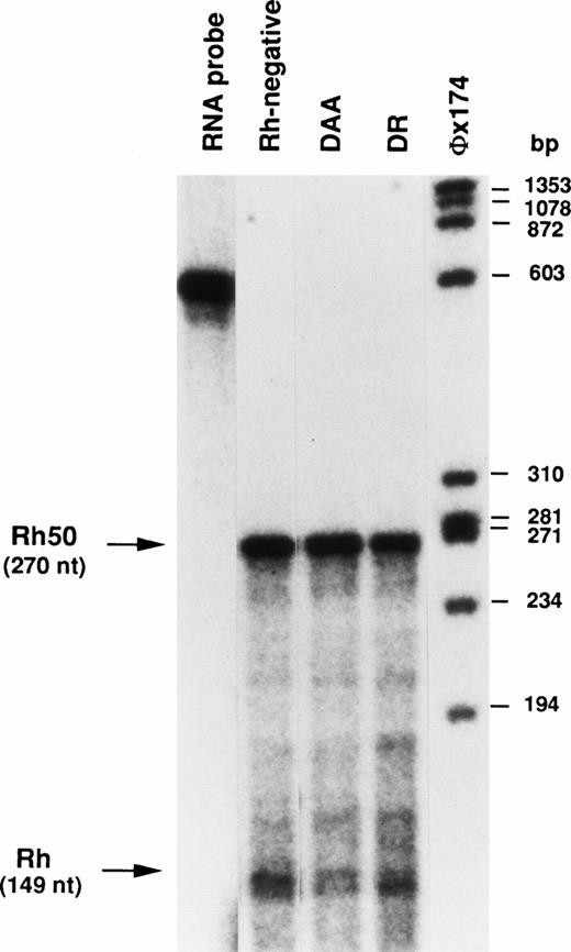 Fig. 5. Ribonuclease protection analysis of RhCE and Rh50 mRNAs. Total reticulocyte RNAs (25 μg) protected fragments of 149 nt and 270 nt from Rh and Rh50, respectively. The ratio between Rh and Rh50 hybridizing signals is equivalent in the Rh-negative control and in DR, whereas it is clearly lower in DAA (see text). The chimeric Rh-Rh50 RNA probe was 568 nt (see the Materials and Methods). A radiolabeledHae III digest of phage øX174 was used as size marker.