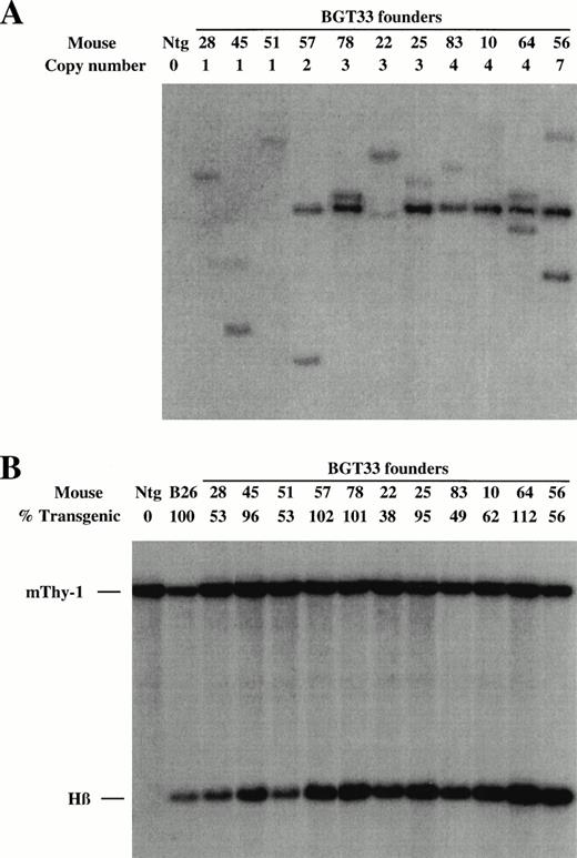 Fig. 2. Determination of transgene copy number and mosaicism in embryonic day 15.5 F0 transgenic mice containing the BGT33 construct. (A) Copy numbers of BGT33 transgenic mice determined by Southern blot analysis of F0 fetal head DNA digested withBamH1 and hybridized with the βivs2 probe. (B) Transgene mosaicism levels determined by Southern blot analysis of Acc1 digested DNA extracted from BGT33 fetal livers and hybridized with the βivs2 (Hβ) and mouse Thy-1 (mThy-1) probes. The percentage of transgenic cells was calculated by comparison of the Hβ band intensity of each BGT33 transgenic mouse with the one copy-bred line (B26), taking into account copy number and the mThy-1 loading control (see Materials and Methods).