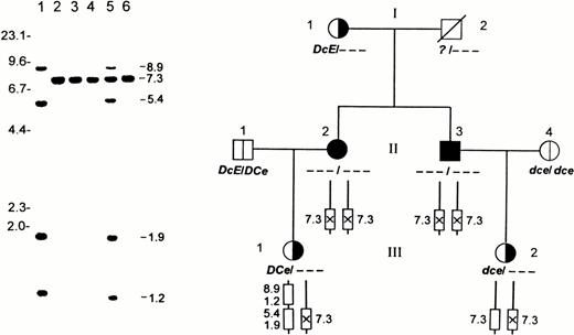 Fig. 1. Gross structure of RH30 locus in the amorph Rhnull family as determined by Sph I RFLPs. (Left) Southern blot analysis of 4 members from the Rhnull family. Lane 1, D-positive; lane 2, D-negative; and lanes 3 through 6, family members II-2, II-3, III-1, and III-2, respectively. Genomic DNAs were digested with Sph I and the polymorphic regions spanning exons 4-7 are shown. Note that RhD gene bands (8.9 and 1.2 kb) are missing in II-2, II-3, and III-2, whereas the RH50 locus is grossly normal in all members (gels not shown). Size marker (in kilobases) of λ phage DNA cleaved by HindIII is indicated. (Right) Family pedigree transmitting a putative amorph Rhnull disease gene. I-1, I-2 (deceased), II-1, and II-4 were not available for molecular analyses. II-2 (propositus) and II-3 are Rhnullhomozygotes, whereas their children, III-1 and III-2, are heterozygotes. The genotype of each member was deduced from RFLP analysis and phenotyping. The amorph copy of RhCe gene on RhD deletion background is denoted by a crossed box with a vertical line.
