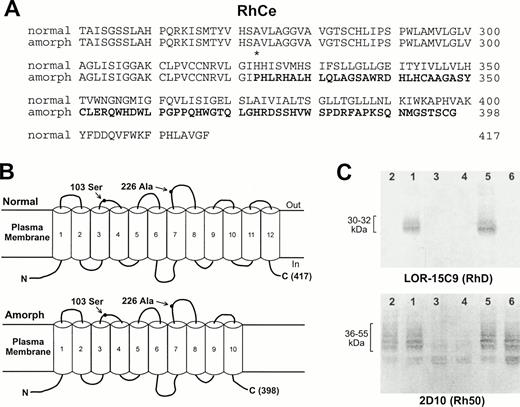 Fig. 4. The deduced amino acid sequence and topology of amorph RhCe from the 2 Rhnull patients. (A) Comparison of the sequence between the normal (residues 251-417) and putative amorph RhCe protein (residues 251-398). The frameshift starts from Pro323 (marked by a star) and the new stretch of 76 amino acids terminates at Gly398 (bold). (B) Topology and organization of the putative amorph protein in the membrane. The amorph protein lacks the last 2 TM domains and does not express any Rh antigens, although it contains C and e antigen-specific polymorphisms, Ser103 and Ala226, on the second and fourth exofacial loops. (C) Immunoblot analysis of Rh30(D) and Rh50 proteins in the Rhnull membrane. The upper panel was probed with antibody LOR-15C9 and the lower one with 2D10. Lane designations are as in Fig 1. Note that no RhD protein was detected in D-negative and Rhnull patients, as expected. In contrast, a significant amount of Rh50 protein was present in the Rhnull cells.