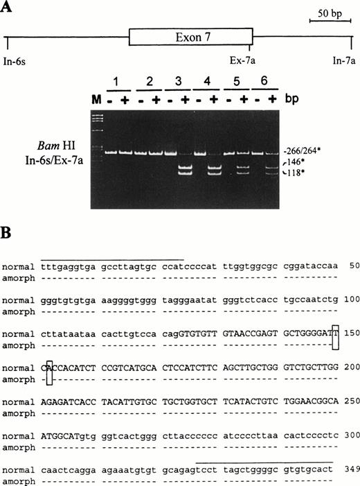Fig. 5. Family inheritance of the amorph Rhnull gene. (A) The genomic region encompassing exon 7 of RhCE gene was amplified by 2 pairs of primers In-6s/Ex-7a and In-6s/In-7a (Table 1). The In-6s/Ex-7a fragments were cut by BamHI (G↓GATCC), which is diagnostic of the mutation, and separated by native 6% PAGE. Although no cleavage is seen in control lanes, the respective fragments of 264 bp (denoted by a star) were cut completely in the Rhnullpatient and partially in the heterozygotes. (B) Sequencing of the genomic fragments In-6s/In-7a. The 2 patients showed the same mutation, 2 deleted nucleotides (966T and 968A, boxed), in this fragment, which was sequenced on both strands. Intronic nucleotides are denoted by lowercase letters and exonic ones by uppercase letters. Dashes indicate identical nucleotides. The 2 primers for PCR amplification are overlined.