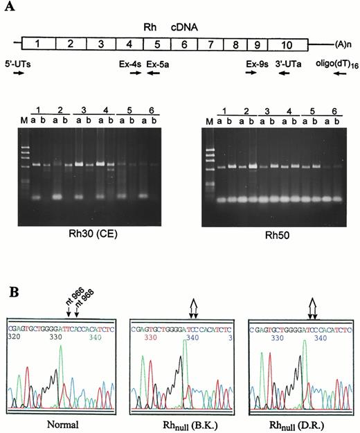 Fig. 3. Identification of the novel mutation in RhCe gene by RT-PCR and sequencing. (A) Strategy for synthesis and amplification of Rh30 cDNA. Rh30 mRNA was reverse-transcribed into cDNA with either the gene-specific 3′-UTa primer or (dT)16 oligomer and then amplified with two pairs of upstream primers (Table 1). The cDNA products for Rh30 (left panel) and Rh50 (right panel) were separated on 1.8% agarose gels. Designations 1 through 6 are as in Fig 1. Lane a, 5′-UT/Ex-5a segment; lane b, Ex-4s/3′-UTa segment. Bands at bottom are primer dimers. (B) Nucleotide sequencing profiles for the novel double mutation identified in the amorph form of RhCe cDNAs from the 2 Rhnull patients (B.K. and D.R.). The mutation affects 2 codons (322 and 323) in exon 7, involving 2 single nucleotide deletions, ATT→AT (nt 965 or 966) and CAC→CC (nt 968) (indicated by arrow).