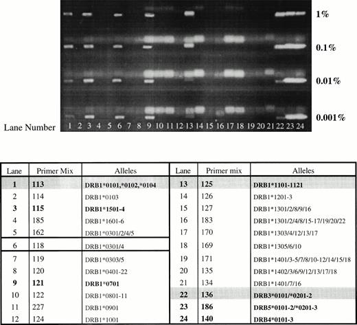Fig. 1. Sensitivity and specificity of nested PCR-SSP typing. DNA from one individual (HLA-DRB1*0102, *1101/4; DRB3*0202/3) was mixed with DNA of known type (HLA-DRB1*1501, *0701; DRB4*0101; DRB5*01) at relative concentrations of 1%, 0.1%, 0.01%, and 0.001%. DNA mixtures were typed using nested PCR-SSP and products analyzed by agarose gel electrophoresis. All HLA alleles from the donor can be detected to a level of 0.001% (donor and recipient lanes are in bold type, with donor lanes also shaded. The lane yielding the false amplification is outlined).