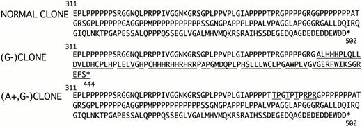 Fig. 1. Comparison of amino acid sequence from Glu311 to the C terminal part of the each WASP allele. The underlined characters indicate substitution of the original sequence. The asterisk denotes the stop codon.