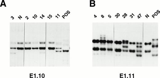 Fig. 1. Genetic analysis of BCL-65′ mutations in PCNSL by PCR-SSCP (A and B) and DNA direct sequencing (C and D). (A and B): Representative results obtained for PCR products E1.10 (A) and E1.11 (B) are shown. Samples of PCNSL are indicated at the top of each lane by a numbered code. A positive control (POS), represented by a tumor sample known to harborBCL-6 5′ mutations, as well as a normal (N) sample, represented by a lymphoblastoid cell line, are also included for each PCR-SSCP fragment shown. Samples were scored positive when their migration pattern differed from the normal control and the migration abnormalities could not be ascribed to population polymorphisms. Among the PCNSL samples shown, cases scored as positive included cases 3, 14, and 11 (for PCR product E1.10); 8, 28, and 47 (for PCR product E1.11). (C and D): Nucleotide sequencing analyses of BCL-65′ mutations in PCNSL (cases 14, 43, and 47). The sequence of each PCNSL case is matched either to the sequence of a normal control (N) displaying germline BCL-6 alleles (D) or to the sequence of a PCNSL sample harboring mutations at a different site (C). The position of mutations is indicated by the nucleotide number of the corresponding BCL-6 germline sequence (the first nucleotide of the BCL-6 cDNA was arbitrarily chosen as position +1).