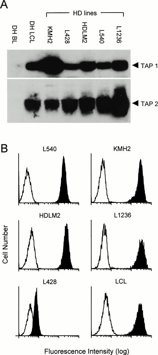 Fig. 2. Expression of TAP 1, TAP 2, and HLA class I in HD-derived cell lines. Five H-RS lines plus an LCL and BL cell line from donor DH were analyzed by Western blotting for expression of TAP 1 and TAP 2 (A). Viable cells from the H-RS cell lines plus an LCL were also analyzed by FACScan for surface expression of HLA class I using the MoAb W6/32 (B). Clear profile, staining with second step antibody alone; shaded profile, W6/32 staining. Results shown are representative of those observed in several repeated assays.