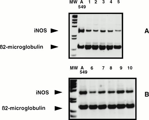Fig. 1. Detection of iNOS mRNA in human B-CLL cells by RT-PCR. Total RNAs from 10 different human B-CLL cell samples (1 through 10) and from the A549 cell line, tested in two experiments A and B, were reverse transcribed and the cDNA obtained was submitted to 35 cycles of PCR in the presence of human iNOS specific primers, then analyzed by electrophoresis in a 7% acrylamide gel in the presence of BET, as described in Materials and Methods. MW, 1-kb ladder; A549, positive control; lanes 1 through 10, 10 different B-CLL cell samples (five in each panel A and B).