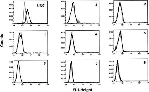 Fig. 3. Lack of ecNOS protein expression detectable in B-CLL cells by flow cytometry. B-CLL cells from eight different patients and U937 cells (positive control of ecNOS expression) were permeabilized with the Cytoperm kit and labeled with either the monoclonal anti-ecNOS or unrelated IgG1 MoAb as an isotype-matched control, then incubated in the presence of a fluoresceinated goat F(ab′)2 anti-mouse Ig antibody. Fixed cells were analyzed by flow cytometry with a FACScan instrument, using the lysis II and Procyt softwares. Gray line, control labeling with IgG1; black line, labeling with anti-ecNOS. The data are representative of a total of 13 different B-CLL cell samples tested.