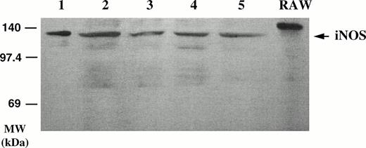 Fig. 4. Detection of iNOS protein in B-CLL cell extracts by Western blotting. Homogenates of five different B-CLL cell samples (lanes 1 through 5) were electrophoresed on acrylamide, blotted onto membranes, and probed with a monoclonal anti-iNOS MoAb (clone 54) and revealed by ECL. Right lane, crude extract from IFN-γ–stimulated murine RAW 264.7 macrophage cell line (positive control of iNOS expression).