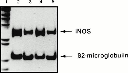 Fig. 5. Ligation of CD23 on B-CLL cells increases iNOS mRNA expression. Total RNA was extracted from A549 cells, used as a positive control of iNOS expression (lane 2) and from one B-CLL cell sample, either at time 0 of the start of the culture (lane 3), or after a 16-hour incubation in the presence of 10 μg/mL of anti-CD23 MoAb 135 (lane 4), or of isotype-matched IgG1 (lane 5). The detection by semi-quantitative RT-PCR of iNOS and β2-microglobulin mRNA was performed using the “Image” software for the quantification of the bands after electrophoresis on a 7% acrylamide gel. Lane 1, 1-kb ladder. Results are from one experiment representative of five performed with different B-CLL cell samples. In addition, ligation of CD23 on B-CLL cells did not induce ecNOS mRNA expression (not shown).