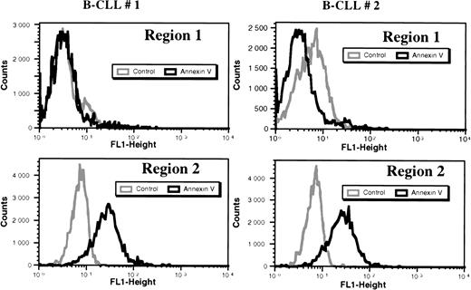 Fig. 9. Distribution of annexin V+ cells in B-CLL cells. Purified leukemic B cells from freshly collected blood samples from two patients were incubated for 48 hours with medium alone, then labeled with FITC-annexin V or an FITC-labeled goat F(ab′)2 anti-rabbit Ig as control. Regions 1 and 2 were determined as before by FACS analysis, according to the SSC/FSC distribution pattern, and the percentage of annexin V+cells was estimated for each region, R1 and R2, using the Procyt software.