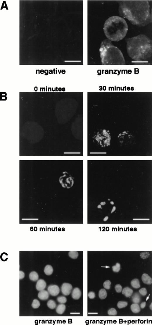 Fig. 1. Granzyme B is internalized independently, but requires perforin to induce apoptosis. Jurkat target cells were incubated in medium containing granzyme B for 0 and 60 minutes at 37°C (A). Cells were fixed in 2% paraformaldehyde and immunolabeled with antigranzyme antiserum and staining with Texas Red-conjugated goat antirabbit antibody. Cells were viewed by CLSM. Granzyme B label was not present at 0 minutes, but appeared in a distinct punctate pattern by 60 minutes. Despite the uptake of granzyme B, there were no detectable signs of cell death. (B) Jurkat target cells were treated with granzyme B, washed to remove soluble granzyme, and incubated in sublytic levels of perforin at 37°C for the times indicated. Cells were labeled for DNA fragmentation by the TUNEL protocol with dUTP-FITC. Granzyme B+ targets showing the progression of DNA fragmentation observed in apoptotic death induced by granzyme B and perforin from a healthy cell (0 minutes); early DNA fragmentation observed at early time points (30 minutes); an apoptotic cell with considerable DNA fragmentation and reduced nuclear size (60 minutes); and advanced DNA fragmentation and severe nuclear condensation at 120 minutes. (C) Yac-1 targets were treated with granzyme B and buffer or in combination with perforin. Cells were labeled with the DNA-binding dye DAPI and viewed by fluorescence microscopy. Examples of condensed nuclei of apoptotic cells are indicated by arrows. Scale bar is 10 μm.