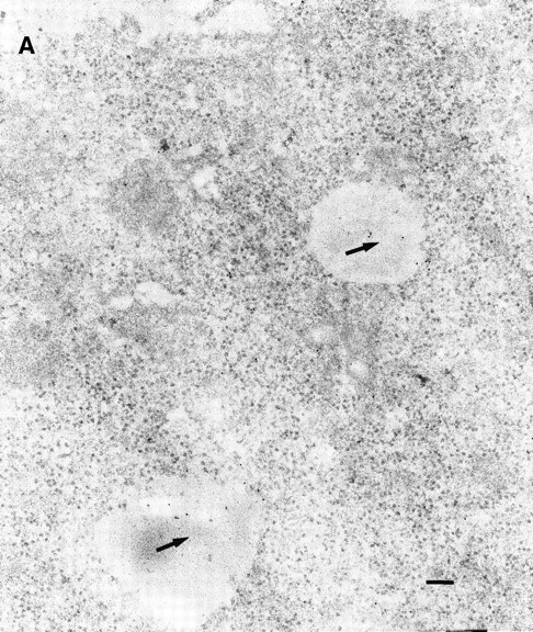 Fig. 6. Immunoelectron microscopy of granzyme B in its intracellular compartment. (A) HeLa cells were treated with granzyme B as in Fig 4B, except that after binding of granzyme B to the cell surface at 4°C, cells were moved to 37°C to allow transport to its retention compartment. Labeling with antibody against granzyme B followed by 10 nm gold-conjugated secondary antibody demonstrates that granzyme B is retained in a compartment with morphologic characteristics different from rab4+ endosomes shown in Fig 4B. (B) HeLa cells were treated with granzyme B as in (A). Sections were incubated with antibodies to granzyme B and antisera against rab5 followed by corresponding secondary antibodies conjugated to 10 nm and 18 nm gold particles for granyzme B and rab5, respectively. At 37°C, granzyme B, denoted by arrows, was found primarily in a compartment not containing rab5. However, the more electron dense endosomal vesicles containing rab5 (denoted by filled arrows) are only occasionally labeled with granzyme B (open arrowhead). The morphology of the compartment containing granzyme B is distinct from the rab5 compartment. As a negative control in both panels, sections were labeled with each gold-conjugated secondary antibody in the absence of the corresponding primary antibody or antiserum. Sections treated in this manner did not display any labeling (data not shown). Scale bars are 0.1 μm.