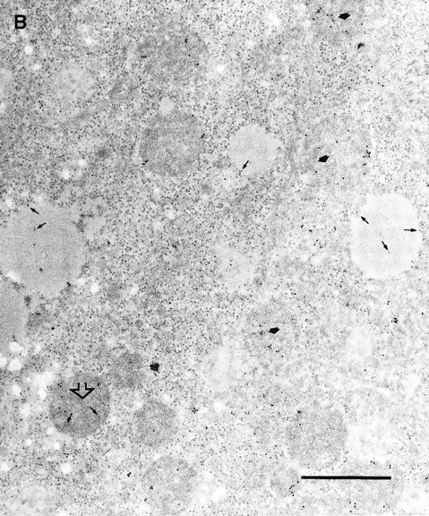 Fig. 6. Immunoelectron microscopy of granzyme B in its intracellular compartment. (A) HeLa cells were treated with granzyme B as in Fig 4B, except that after binding of granzyme B to the cell surface at 4°C, cells were moved to 37°C to allow transport to its retention compartment. Labeling with antibody against granzyme B followed by 10 nm gold-conjugated secondary antibody demonstrates that granzyme B is retained in a compartment with morphologic characteristics different from rab4+ endosomes shown in Fig 4B. (B) HeLa cells were treated with granzyme B as in (A). Sections were incubated with antibodies to granzyme B and antisera against rab5 followed by corresponding secondary antibodies conjugated to 10 nm and 18 nm gold particles for granyzme B and rab5, respectively. At 37°C, granzyme B, denoted by arrows, was found primarily in a compartment not containing rab5. However, the more electron dense endosomal vesicles containing rab5 (denoted by filled arrows) are only occasionally labeled with granzyme B (open arrowhead). The morphology of the compartment containing granzyme B is distinct from the rab5 compartment. As a negative control in both panels, sections were labeled with each gold-conjugated secondary antibody in the absence of the corresponding primary antibody or antiserum. Sections treated in this manner did not display any labeling (data not shown). Scale bars are 0.1 μm.
