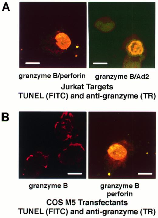 Fig. 2. Perforin and Ad2 cause an intracellular redistribution of granzyme B. (A) Jurkat cells were pretreated with granzyme B at 37°C for 60 minutes to allow uptake of granzyme. Cells were washed and incubated in either perforin or Ad2. Cells were immunolabeled for granzyme B and Texas Red (TR)-conjugated secondary antibody (red) and TUNEL labeled with dUTP-FITC (green). Regions of colocalization appear yellow. The punctate cytoplasmic labeling pattern of granzyme B alone (see Fig 1 A) was disrupted and nuclear accumulation of granzyme B was evident. The presence of granzyme B in the nucleus coincided with sites of DNA fragmentation detected by the TUNEL protocol. (B) COS M5 cells were transiently transfected to express granzyme B. After 48 hours, cells were treated with buffer as a negative control or perforin and labeled for granzyme B (TR) and TUNEL (dUTP-FITC) as in (A). In the absence of perforin, granzyme B appeared to be contained in a cytoplasmic structure, but was redistributed in the presence of perforin. As with Jurkat targets, COS cells containing granzyme B underwent rapid apoptosis when treated with perforin and nuclear granzyme B was colocalized with sites of TUNEL-labeled DNA fragmentation. Scale bar is 10 μm.