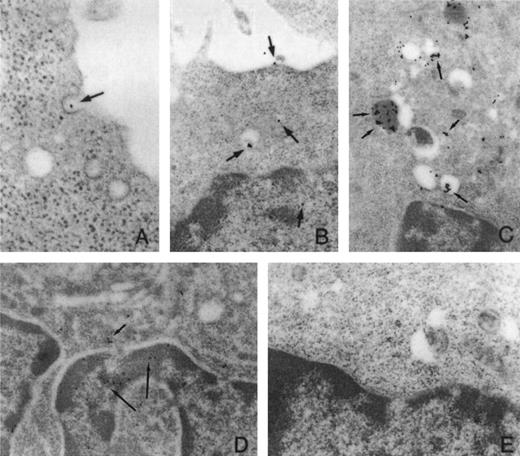 Fig. 5. ODN Uptake. (A) ODN is found in clathrin coated pits indicative of receptor-mediated endocytosis. (B and C) ODN can be found in lysosomal (clear vesicles) or endosomal compartments (vesicles filled with darker material); however, some ODN is free and (D) crosses the nuclear membrane to presumably form hybrids with target mRNA. (E) Control panel labeled with Biotin alone. Oligodeoxynucleotides have been decorated with gold beads that appear has black dots in the photomicrograph. Their location is pointed to by black arrows. (Reproduced from The Journal of Clinical Investigation, 1995, vol 95, p 1814 by copyright permission of The American Society for Clinical Investigation.147)