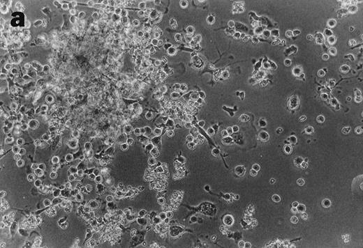 Fig. 4. Anti-TNF–treated GTS cultures produce distinct progeny in methylcellulose and liquid cultures, compared with GTS cultures. GTS cultures yielded typical DC colonies around day 12 in methylcellulose (a) and adherent DC clusters in liquid cultures (c). In methylcellulose, anti-TNF–treated GTS cultures produced large CFUs containing small round cells and lacking typical DCs (b). The liquid anti-TNF–treated cultures (d) contained predominantly nonadherent cells. Original magnification × 20.