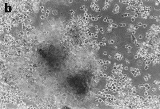Fig. 4. Anti-TNF–treated GTS cultures produce distinct progeny in methylcellulose and liquid cultures, compared with GTS cultures. GTS cultures yielded typical DC colonies around day 12 in methylcellulose (a) and adherent DC clusters in liquid cultures (c). In methylcellulose, anti-TNF–treated GTS cultures produced large CFUs containing small round cells and lacking typical DCs (b). The liquid anti-TNF–treated cultures (d) contained predominantly nonadherent cells. Original magnification × 20.