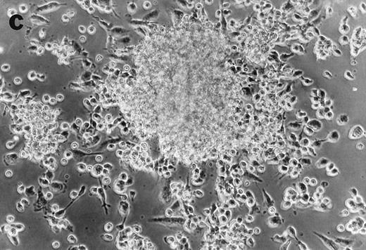 Fig. 4. Anti-TNF–treated GTS cultures produce distinct progeny in methylcellulose and liquid cultures, compared with GTS cultures. GTS cultures yielded typical DC colonies around day 12 in methylcellulose (a) and adherent DC clusters in liquid cultures (c). In methylcellulose, anti-TNF–treated GTS cultures produced large CFUs containing small round cells and lacking typical DCs (b). The liquid anti-TNF–treated cultures (d) contained predominantly nonadherent cells. Original magnification × 20.