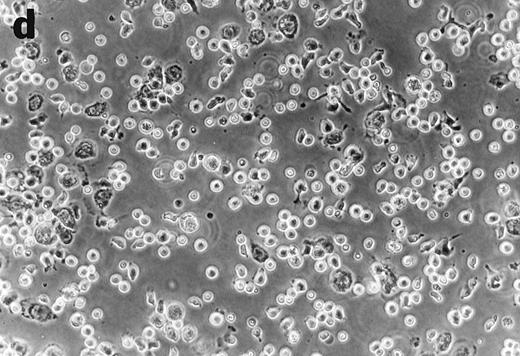 Fig. 4. Anti-TNF–treated GTS cultures produce distinct progeny in methylcellulose and liquid cultures, compared with GTS cultures. GTS cultures yielded typical DC colonies around day 12 in methylcellulose (a) and adherent DC clusters in liquid cultures (c). In methylcellulose, anti-TNF–treated GTS cultures produced large CFUs containing small round cells and lacking typical DCs (b). The liquid anti-TNF–treated cultures (d) contained predominantly nonadherent cells. Original magnification × 20.