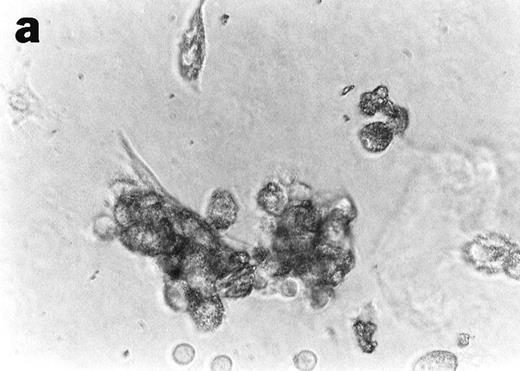 Fig. 6. Anti-TNF–treated GTS cultures contain myeloid progenitors with CFU potential on day 10. Cells removed from anti-TNF–treated GTS cultures on day 10 and placed in methylcellulose with GM-CSF+SCF yielded colonies resembling mono CFU (a) and granulocyte CFU (b). Nonspecific esterase (c) and Wright stain (d) analysis confirmed the presence of both mono-macrophages and granulocytes. Original magnification for (a), (b), and (d) = 40×, for (c) = 60×. Cells removed from untreated GTS cultures on day 10 and cultured in parallel failed to yield CFU.