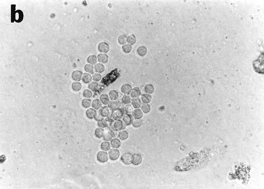 Fig. 6. Anti-TNF–treated GTS cultures contain myeloid progenitors with CFU potential on day 10. Cells removed from anti-TNF–treated GTS cultures on day 10 and placed in methylcellulose with GM-CSF+SCF yielded colonies resembling mono CFU (a) and granulocyte CFU (b). Nonspecific esterase (c) and Wright stain (d) analysis confirmed the presence of both mono-macrophages and granulocytes. Original magnification for (a), (b), and (d) = 40×, for (c) = 60×. Cells removed from untreated GTS cultures on day 10 and cultured in parallel failed to yield CFU.