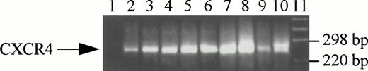 Fig. 1. CXCR4 gene expression in normal bone marrow CD34+ cells, megakaryocytes, platelets, and megakaryocytic cell lines. RT-PCR was performed as described in Materials and Methods. The PCR products were electrophoresed on a 3% agarose gel and visualized by ethidium bromide staining. RNA isolated from CXCR4-transfected L1.2 cells was used as a positive control and RT-PCR without RNA was used as a negative control. Lanes 1 through 11 represent negative control, CD34+ cells, CD61+ cells, platelets, HEL, CMK, Dami, Mo7E, UT-7, positive control, and DNA marker, respectively.