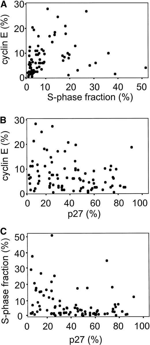 Fig. 2. Scatter diagram showing the distribution of cyclin E, p27, and S-phase fraction in lymphoma samples. (A)rs = .45, P < .001, n = 98; (B)rs = −.24, P = .02, n = 93; (C)rs = −.35, P < .001, n = 100.