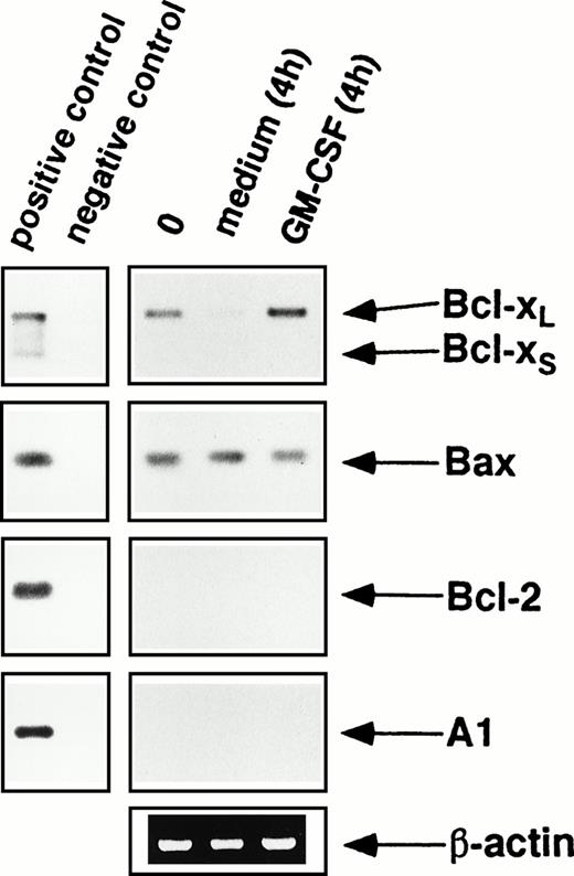 Fig. 1. mRNA expression of Bcl-2 family members by purified blood eosinophils as assessed by RT-PCR using 20 cycles of amplification. Freshly isolated peripheral blood eosinophils (0) expressed significant levels of mRNA for Bcl-xL and Bax, but not for Bcl-2, Bcl-xS, and A1. When eosinophils were cultured in medium without cytokine support, the levels of Bcl-xL rapidly decreased, but were maintained or slightly increased after GM-CSF stimulation in vitro. In contrast, Bax mRNA levels remained unchanged when eosinophils were cultured in the presence or absence of GM-CSF. The same results were observed when eosinophils were cultured with IL-5 (not presented). Furthermore, Bcl-2 and A1 mRNA levels did not increase after incubation with eosinophil hematopoietins. As a control, human β-actin cDNA was amplified and PCR products were stained by ethidium bromide in an agarose gel. Positive control amplifications were performed using cDNAs from HL-60 (Bcl-x, Bax, Bcl-2) and Jurkat (A1) cells. All data are representative of eight independent experiments.