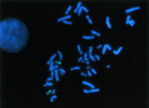 Fig. 1. FISH analysis of the p53 gene at 17p13 using a specific DNA probe (red fluorescent signals), hybridized simultaneously with a chromosome 17-centromeric probe (green fluorescent signals). Probes were applied to normal, phytohemagglutinin-stimulated lymphocytes and a metaphase spread as well as an interphase nucleus showing a normal hybridization pattern are displayed.