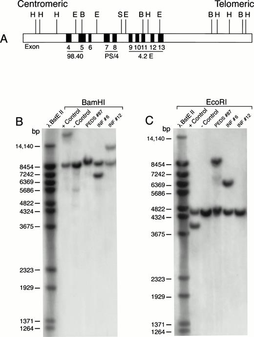 Fig. 4. MLL rearrangement in leukemic cells from patients with ALL. Genomic DNA was digested with BamHI or EcoRI restriction enzymes, separated by electrophoresis, blotted to nylon membranes, and hybridized with the radiolabeled P/S4 probe. (A) Probes for analysis of MLL gene rearrangement. Partial restriction map of the 11q23 region containing the MLL gene. Approximate positions of MLL exons 4 through 13 (of 21 exons) are shown as gray boxes. Areas mapped by probes P/S4, 98.40, and 4.2E are indicated. Abbreviations: H, HindIII; E, EcoRI; B, BamHI; S, Sac I. (B) BamHI digest. (C) EcoRI digest. RS4;11 cells were used as a positive control and normal peripheral lymphocytes served as a negative control. bp, base pairs.