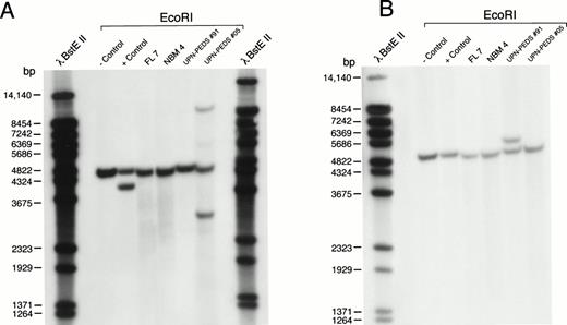 Fig. 5. MLL rearrangement in leukemic cells, normal BM, and fetal liver. Genomic DNA was digested with EcoRI, separated by electrophoresis, blotted to nylon membranes, and hybridized with the radiolabeled probes. (A) P/S4 probe. (B) 98.40 probe. RS4;11 cells were used as a positive control and normal peripheral lymphocytes served as a negative control. FL7 was isolated from a fetus age 19 gestational weeks. NBM4 was a BM sample from a normal infant BM donor age 6 months. UPN-PEDS no. 91 was a male age 17.7 years with newly diagnosed t(4;11) ALL. UPN-PEDS no. 5 was a female age 2.9 years with newly diagnosed normal diploid ALL. bp, base pairs.