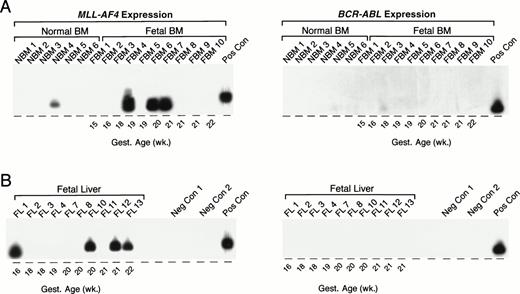 Fig. 7. Detection of MLL-AF4 fusion transcripts in normal hematopoietic cells by Southern blot analysis. (A) PCR products from normal infant and fetal BM. (B) PCR products from fetal liver. PCR products were transferred to nylon membranes and hybridized as described in Materials and Methods with 32P-labeled oligonucleotide detection probes for MLL-AF4 andBCR-ABL. Amplified mRNA from the RS4;11 and patient UPN100, with t(9;22)+ ALL, were used as positive controls (Pos Con) for MLL-AF4 and BCR-ABL fusion transcripts, respectively. Negative controls (Neg Con) were PCR products from RNA-free reaction mixture 1 plus reaction mixture 2 (negative control 1) and reaction mixture 1 plus DNA polymerase-free reaction mixture 2 (negative control 2). Gest., gestational.