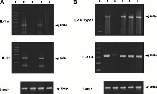 Fig. 2. PCR analysis of the expression of cytokines in MS-10 cells and their receptors in HB-1 cells by the coculture of MS-10 and HB-1 cells. (A) Expression of IL-1α and IL-11 in MS-10 cells was analyzed by RT-PCR after coculture with HB-1 cells. Each lane represents MS-10 cells alone (lane 3), MS-10 cells cocultured with HB-1 cells (lane 4), and HB-1 cells cocultured with MS-10 cells (lane 5), respectively. LPS-stimulated MS-5 cells were used as positive control (lane 2). Marker was 100 bp ladders (lane 1). (B) Expression of IL-1 receptor type I and IL-11 receptor in HB-1 cells was analyzed by RT-PCR after coculture with MS-10 cells or after IL-1α stimulation. Each lane represents HB-1 cells separated from MS-10 cells for 5 days (lane 3), HB-1 cells cocultured with MS-10 cells (lane 4). HB-1 cells separated from MS-10 cells for 5 days were reseeded on MS-10 cells again and harvested 5 days later (lane 5) or cultured in the presence of IL-1α and harvested 5 days later (10 U/mL) (lane 6). C3H/HeN spleen cells were used as positive control (lane 2). Marker was 100 bp ladders (lane 1).