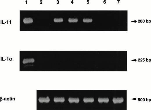 Fig. 6. Induction of IL-11 production in MS-10 cells by the coculture with nonadherent BM cells. MS-10 cells were cocultured with nonadherent BM cells for 6, 12, 24, and 48 hours. Expression of the genes for IL-1α and IL-11 in MS-10 cells was analyzed by quantitative RT-PCR, MS-10 alone (lane 2); MS-10 cocultured with nonadherent BM cells for 6 hours (lane 3); 12 hours (lane 4); 24 hours (lane 5); or 48 hours (lane 6); nonadherent BM cells (lane 7). Lane 1 is a positive control.