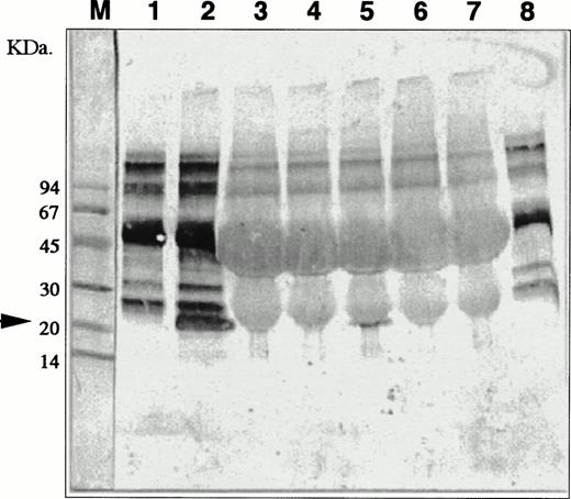 Fig. 7. Detection of IL-11 molecules in conditioned media of the coculture of nonaderent BM cells and MS-10. MS-10 cells were cocultured with nonadherent BM cells for 6, 12, 24, 48, and 72 hours. IL-11 molecules were analyzed by immunochemistry. Negative controls (lane 1, conditioned medium of MS-10 alone and lane 8, 10% FCS in α-medium). Positive control (lane 2, conditioned medium of HB-1 cultured on MS-10). Conditioned medium of MS-10 cocultured with nonadherent BM cells for 6 hours (lane 3); 12 hours (lane 4); 24 hours (lane 5); 48 hours (lane 6); and 72 hours (lane 7). M lane 1 is molecular-weight marker.