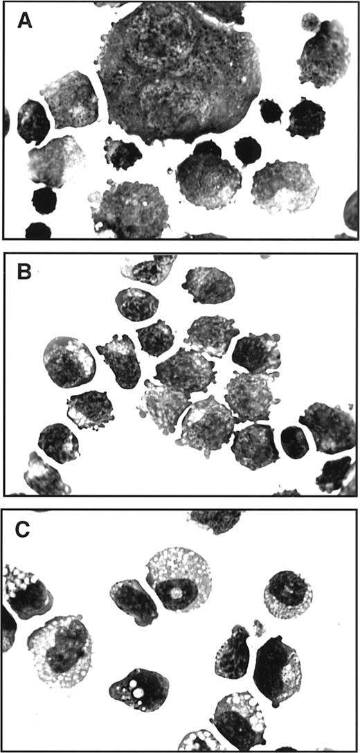 Fig. 2. Morphology of cells in three different EBHX cell lines. EBHX1 (A), EBHX11 (B), and EBHX14 (C). Cells were stained with May-Grünwald and Giemsa. Original magnification × 1,000.