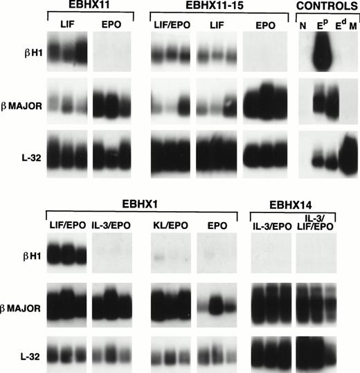 Fig. 6. Globin expression analysis of EBHX-derived colonies. Colonies were grown in the indicated cytokines for 7 days and then picked and analyzed for βH1 and βmajor expression by Poly(A) PCR. The analysis of three individual colonies is shown for each set of conditions. EBHX11-15 is a subclone of EBHX11. Control Eprepresents primitive erythroid colonies grown from day 6 EB precursors, control Ed are definitive erythroid colonies generated from fetal liver precursors, and control M are macrophage colonies grown from day 6 EB-derived precursors. N represents PCR reagents with no cells added. Expression of the ribosomal L32 gene was used as an indication of the amount of material in each lane. Cytokines were used at the concentrations indicated in the legend to Fig 3.