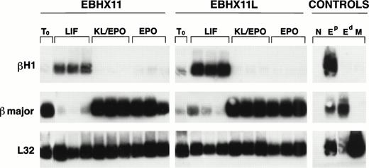 Fig. 7. Globin expression analysis of EBHX11 and EBHX11L cells grown under different conditions. Cells were seeded into microtiter wells at a concentration of 30 or 100 cells per well, maintained in the indicated cytokines for 7 days, and then analyzed for βH1 and βmajor expression by Poly(A) PCR. Three samples from each set of conditions are shown. T0 represents the starting populations. Controls are the same as those in Fig 6. Expression of the ribosomal L32 gene was used as an indication of the amount of material in each lane.