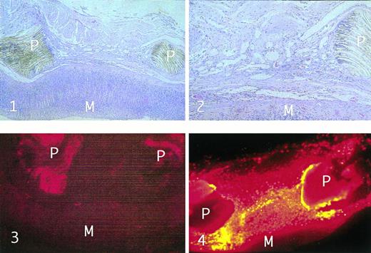 Fig. 2. Histological cross-sections of stomach PTFE implants containing transduced smooth muscle cells. Tissues in panels 1 and 2 were obtained at 12 months postsurgery from a rat that had a hematocrit of 62%, fixed in formalin, and stained with H&E. PTFE implants containing Epo-secreting vascular smooth muscle cells unlabeled (panel 3) or marked with DiI (panel 4) were removed 2 months postsurgery from a rat with a hematocrit of 67%, frozen, sectioned, and photographed using a Nikon Microphot FXA equipped with a rhodamine filter. PTFE material is denoted P, and mucosal tissue as M. (Panels 1, 2, and 4: ×40 original magnification; panel 3: ×100 original magnification.