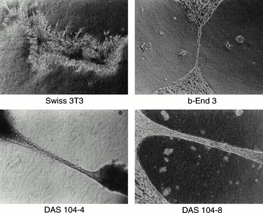 Fig. 2. Capillary formation in vitro. Murine 3T3 fibroblasts, brain-derived capillary endothelial cell line b-End-3, and DAS 104-4 or DAS 104-8 endothelial cell lines were plated in Matrigel, grown for 2 days, and photographed.