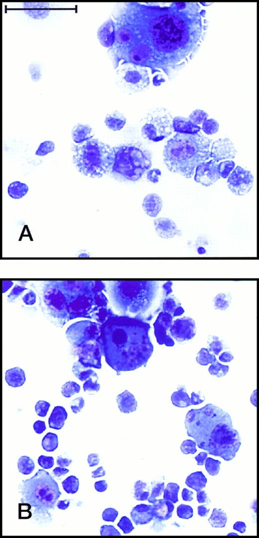 Fig. 4. Wright-Giemsa staining of hematopoietic cells expanded on DAS 104-4 and DAS 104-8. (A) Hematopoietic cells expanded for 7 days on DAS 104-4. The large cells are stromal cells and the small cells are hematopoietic cells. Note the relatively immature morphology of the hematopoietic cells. (B) Hematopoietic cells expanded for 7 days on DAS 104-8. Note the mature macrophage-like appearance of the smaller hematopoietic cells. The bar corresponds to 100 μm.