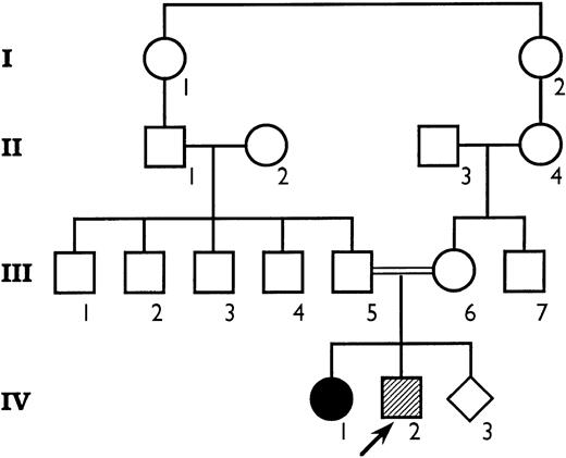 Fig. 1. The pedigree of the family. The propositus is indicated by an arrow. (•), IV.1 died at age 1 month with cerebral hemorrhage and hydrocephaly. (), IV.2 died at age of 12 days with hydrocephalus, intraventricular clots, and cerebral edema.