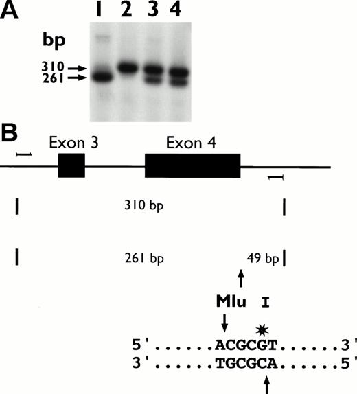 Fig. 4. Restriction endonuclease digestion of PCR products. (A) A fragment spanning exons 3 and 4 and the flanking introns was PCR amplified and digested with the restriction endonuclease Mlu I before electrophoresis on a 2% agarose gel, Southern blotted, and probed with the FVII cDNA sequence. Lane 1, normal control; lane 2, affected child, IV.2; lane 3, father, III.5; lane 4, mother, III.6. (B) Diagrammatic representation of the fragment the Mlu I sites are indicated.