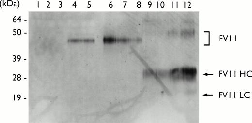 Fig. 6. Western blot analysis of proteins secreted by COS-7 cells into the growth media using a polyclonal antibody against FVII. From concentrated conditioned media 2.5 μg of protein was electrophoresed on a 10% sodium dodecyl sulfate polyacrylamide gel and transferred to nitrocellulose. The FVII was detected using a polyclonal rabbit anti-human FVII antibody (Stago Asserachrom; Shield Diagnostics) and chemiluminescence detection reagents. Lane 1, vector alone; lanes 2 and 3, ▵EGF 1 FVII; lanes 4 and 5, wt FVII; lanes 6 to 8, 5, 2, and 1 ng purified recombinant wtFVII, respectively; lanes 9 to 12, 5, 10, 20, and 50 ng recombinant FVIIa, respectively. The relative sizes of molecular weight markers are shown in kD.