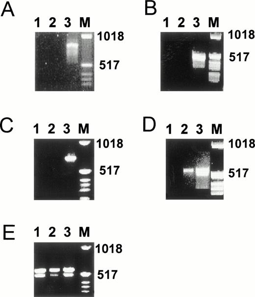 Fig. 9. Presence of estrogen receptors α and β, progesterone receptor, thyroid hormone receptors α and β, and vitamin D receptor mRNA in hMVEC as determined by RT-PCR. hMVEC were cultured for 4 days on gelatin-coated dishes in incubation medium containing 20 ng/mL bFGF and 20 ng/mL TNF-α or in incubation medium from which bFGF and TNF-α was omitted. RNA was isolated from these cells and cDNAs were synthesized using 1 μg total RNA and oligo dT primer as described in Materials and Methods. The cDNAs were amplified with primers for estrogen receptor α (A), estrogen receptor β (B), progesterone receptor (C), vitamin D receptor (D), and thyroid hormone receptors α and β (E) as described in Materials and Methods. The expected length of the amplified DNA fragment of the estrogen receptor α is 832 nt, of the estrogen receptor β 541 nt, of the progesterone receptor 737 nt, of the thyroid hormone receptor α 523 nt, of the thyroid hormone receptor β 458 nt, and of the vitamin D receptor 579 nt. As a positive control for the expression of estrogen receptor α, progesterone receptor, thyroid hormone receptors α and β, and vitamin D receptor mRNA, RNA isolated from MCF7 cells was used. As a positive control for the expression of the estrogen receptor β mRNA, RNA isolated from the SV-HFO osteoblast cell line was used. Lane 1, incubation medium from which bFGF and TNF-α had been omitted; lane 2, incubation medium containing bFGF and TNF-α; lane 3, appropiate positive control; M, molecular weight marker.